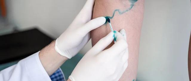 “久坐族”警惕!23岁毕业生赶论文突发下肢静脉血栓 “久坐族”警惕!23岁毕业生赶论文突发下肢静脉血栓