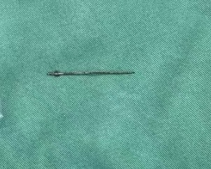 惊险!女子乳房内竟“藏”了一根绣花针 惊险!女子乳房内竟“藏”了一根绣花针