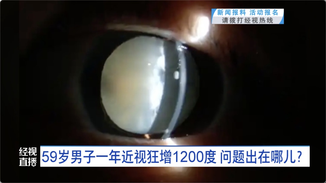 男子一年近视狂增1200度！医生提醒：出现这种情况，请尽早就医