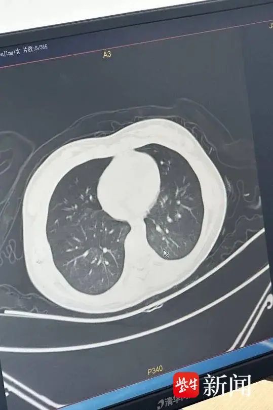 多吃了几口梅干菜，江苏扬州11岁女孩险丧命