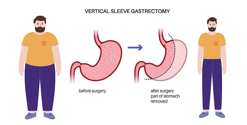 2个人里就有1人中招！上海小伙紧急就医！这件事一定要重视→