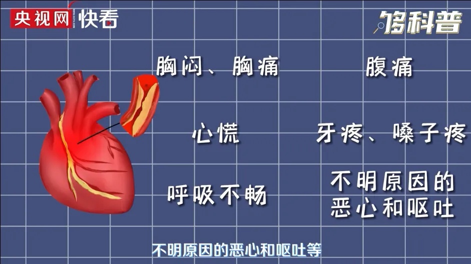 别不当回事！男子牙疼数日，没想到是心肌梗死