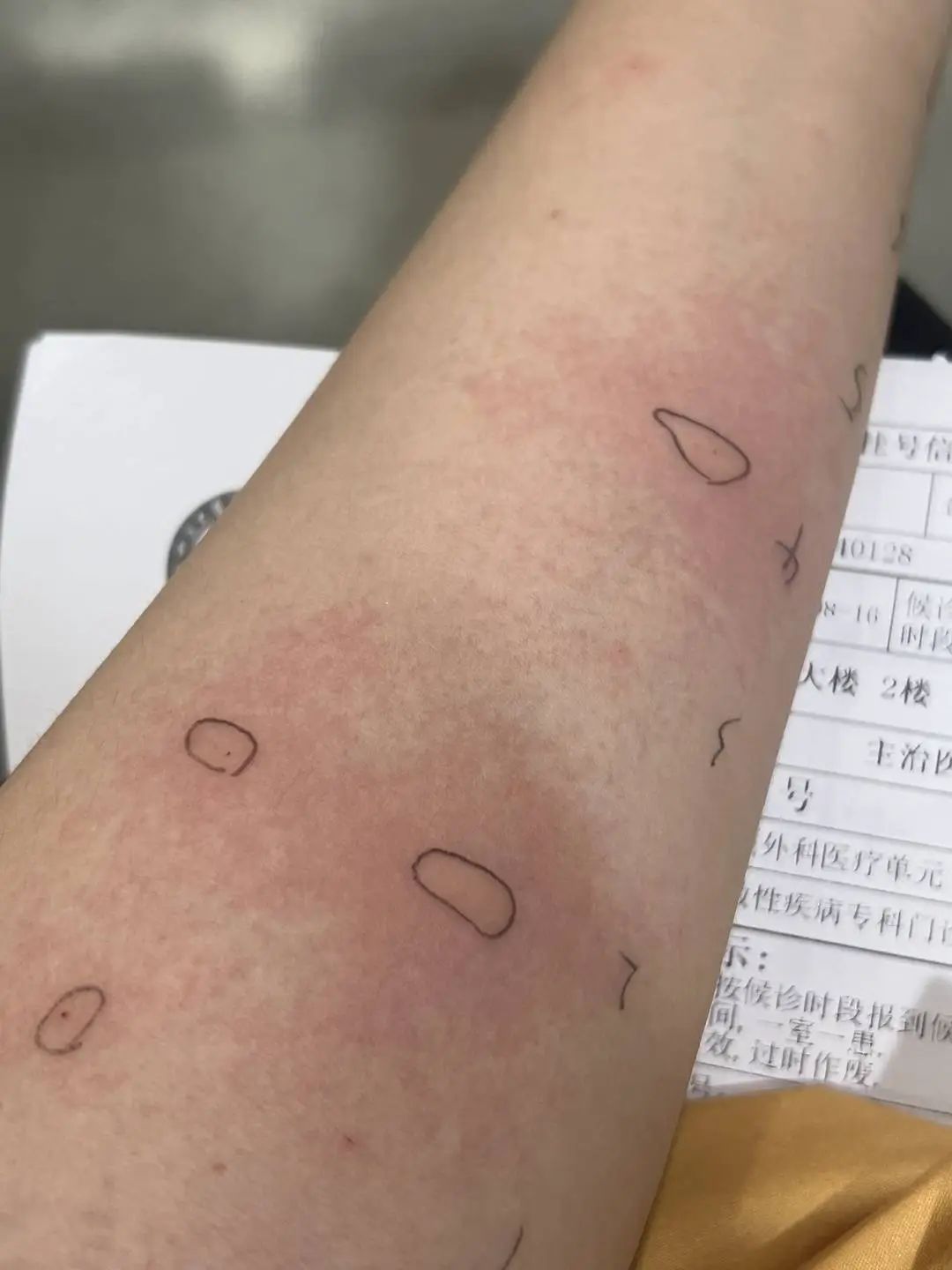 春天花粉过敏，圆柏树成“元凶”？记者调查：城市绿化规划已不再使用