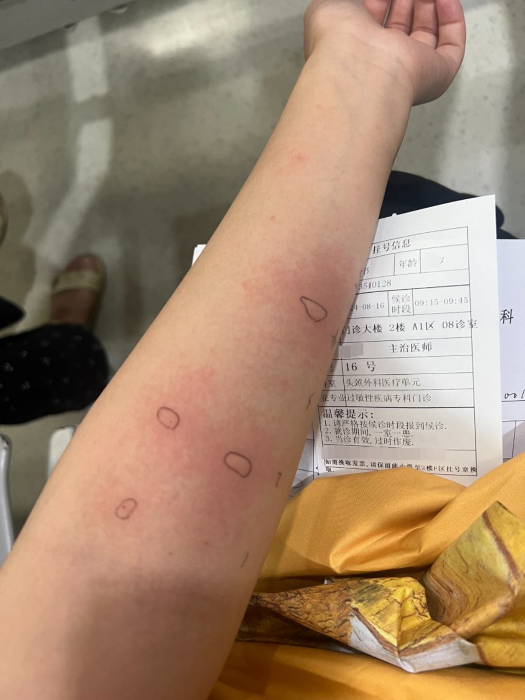 春天花粉过敏，圆柏树成“元凶”？记者调查：城市绿化规划已不再使用