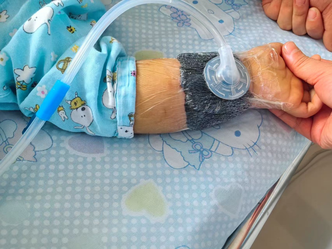 警惕!很多人家中都有,合肥一婴儿被“烧伤” 警惕!很多人家中都有,合肥一婴儿被“烧伤”