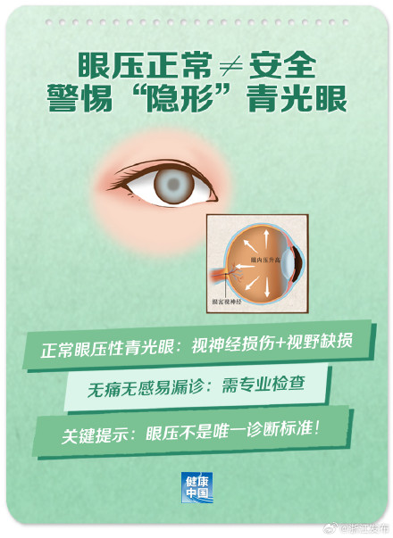 不可忽视!关于青光眼,这些知识你要知道 不可忽视!关于青光眼,这些知识你要知道