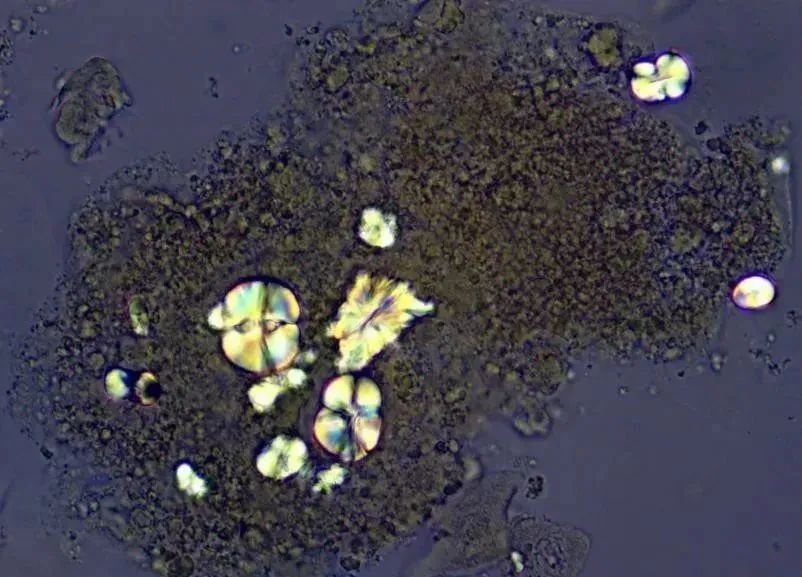 一大盘下肚,女子差点没命!最近很多人饭桌上都有,这个步骤一定不能少 一大盘下肚,女子差点没命!最近很多人饭桌上都有,这个步骤一定不能少