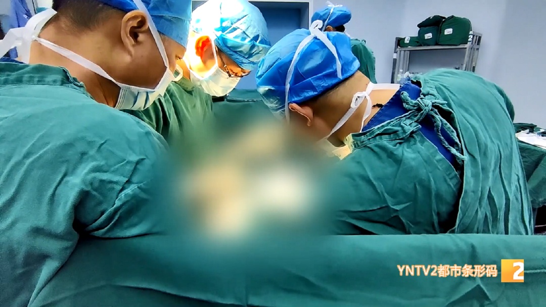 直径超50厘米!约5公斤!女孩腹部巨大肿瘤已相伴20年…… 直径超50厘米!约5公斤!女孩腹部巨大肿瘤已相伴20年……