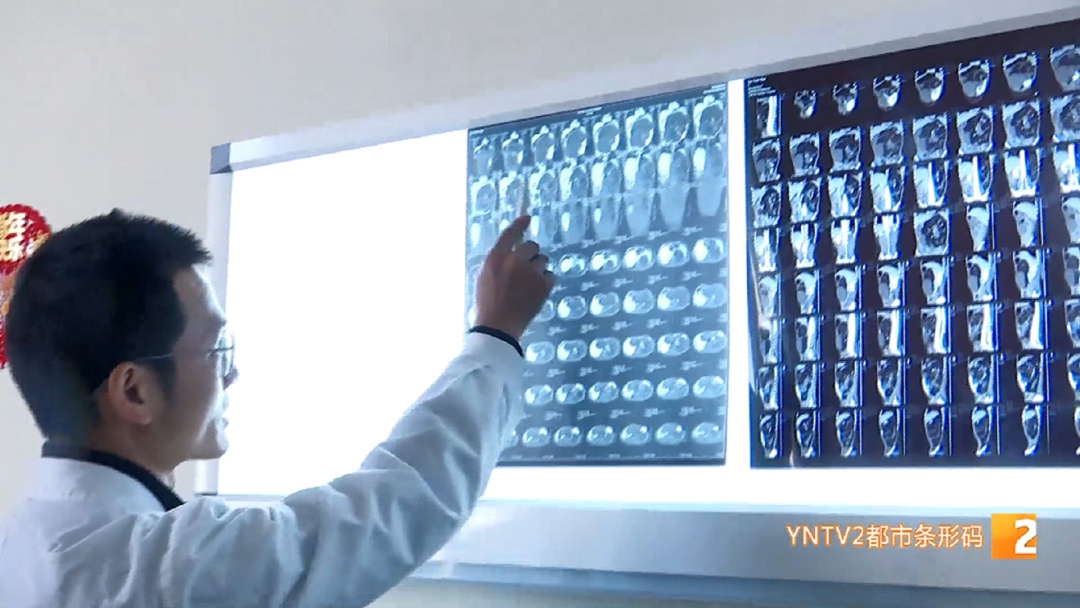 直径超50厘米!约5公斤!女孩腹部巨大肿瘤已相伴20年…… 直径超50厘米!约5公斤!女孩腹部巨大肿瘤已相伴20年……