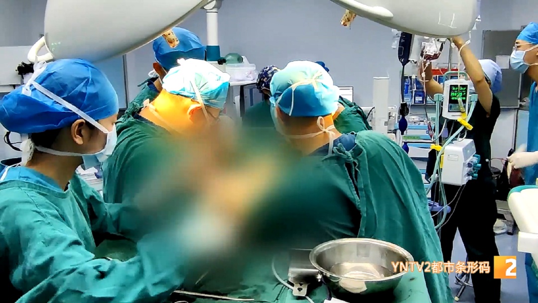 直径超50厘米!约5公斤!女孩腹部巨大肿瘤已相伴20年…… 直径超50厘米!约5公斤!女孩腹部巨大肿瘤已相伴20年……