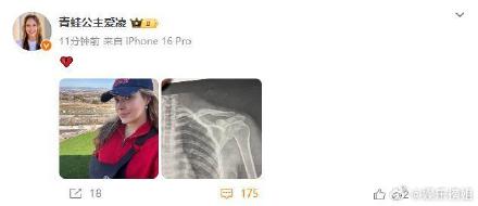 医生称谷爱凌锁骨骨折恢复要6个月 谷爱凌曾多次出现肩手部位伤病 医生称谷爱凌锁骨骨折恢复要6个月 谷爱凌曾多次出现肩手部位伤病