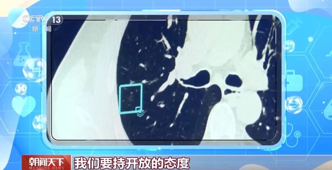 “AI医生”能取代医生吗？听听医药科技专家学者怎么说→