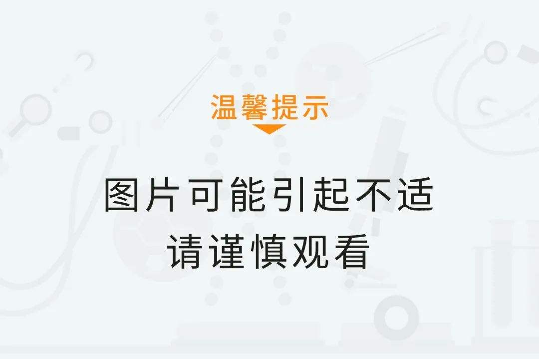 虫虫总动员！春季“虫害地图”曝光，你家上榜了吗？