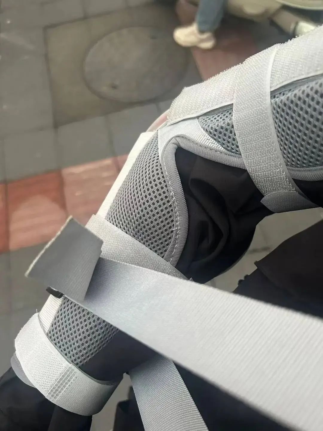 上海一男子骑车上班途中,被流浪猫撞飞!手臂骨折、门牙脱落……到底该找谁索赔? 上海一男子骑车上班途中,被流浪猫撞飞!手臂骨折、门牙脱落……到底该找谁索赔?