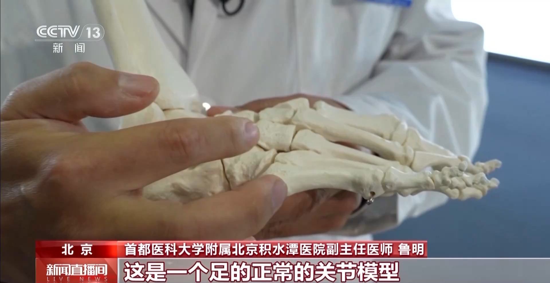 疯狂种草碳板跑鞋？医生：小心足底筋膜炎