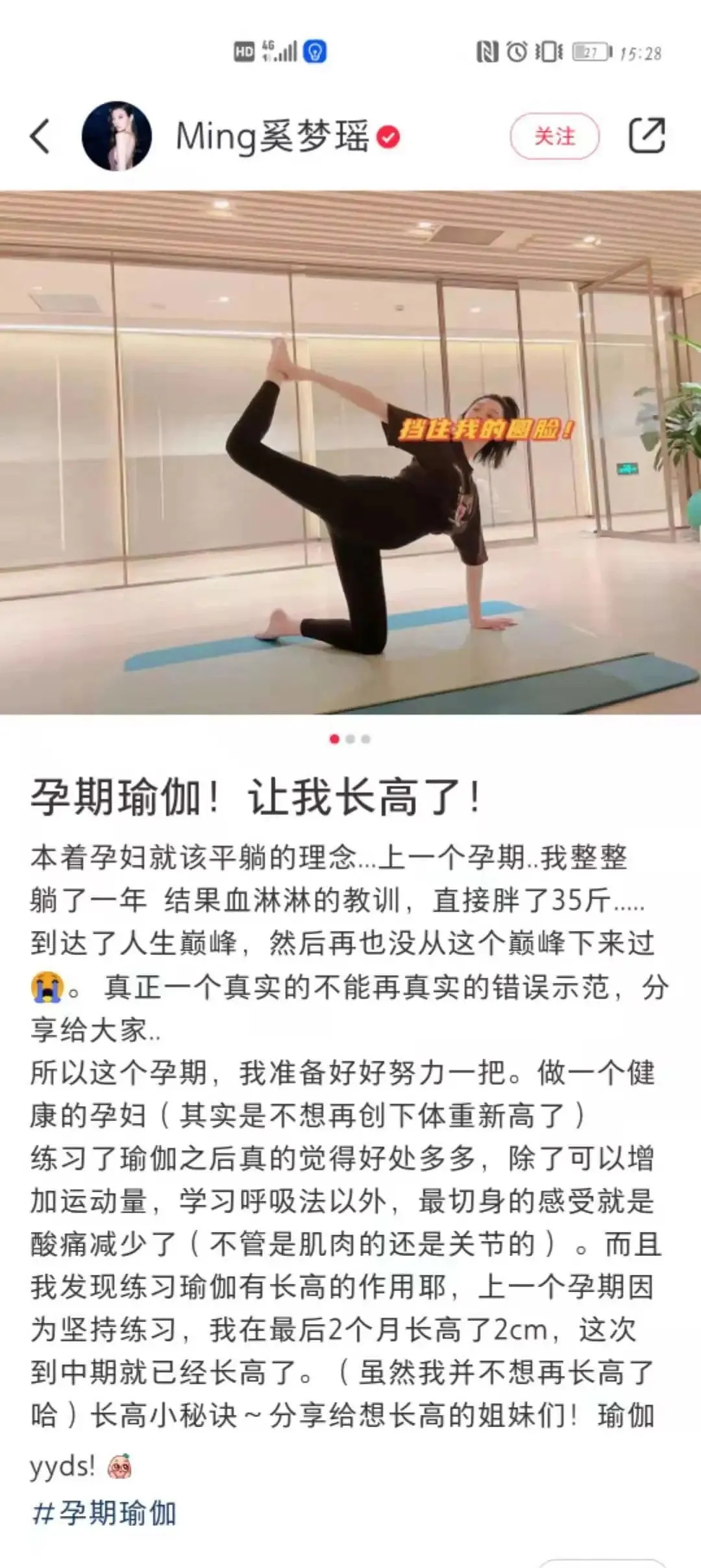 女子生三胎后竟长高了 ，每胎1厘米