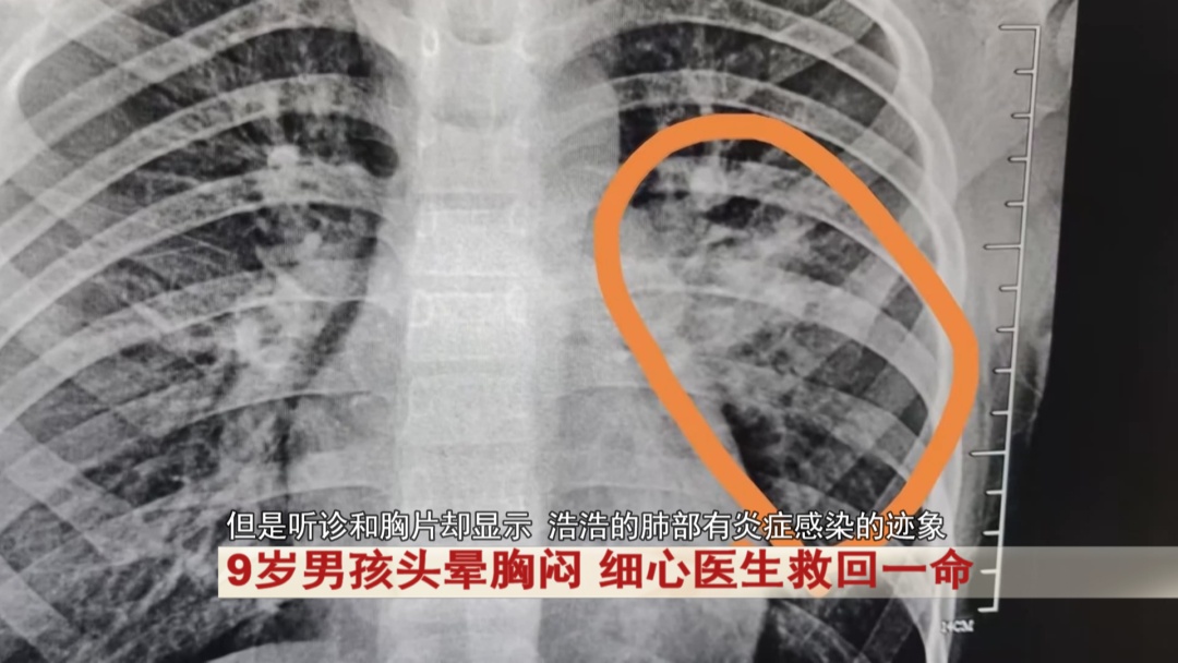 9岁男孩头晕胸闷，被直接送ICU！紧急提醒：千万别硬扛......