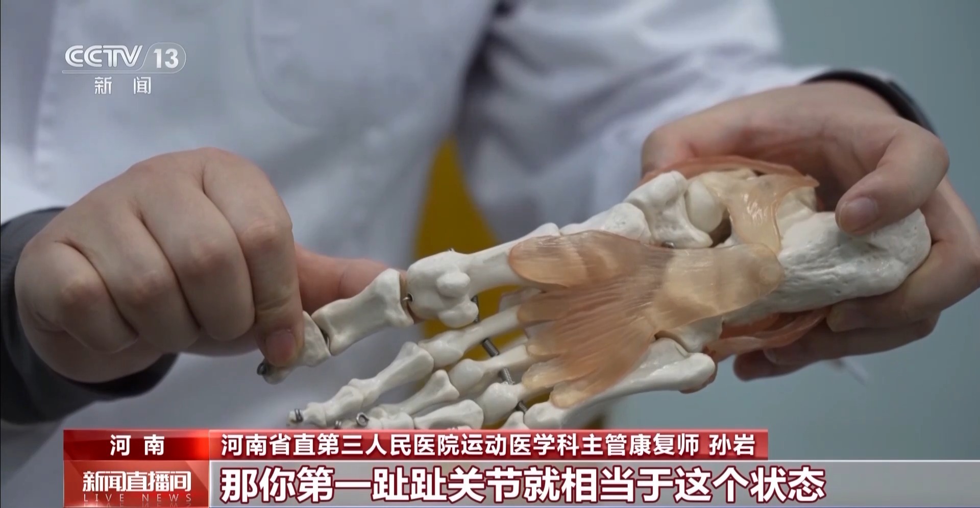 疯狂种草碳板跑鞋？医生：小心足底筋膜炎