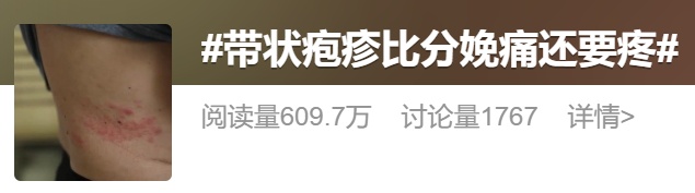 中老年人注意！春季带状疱疹高发，疫苗怎么打？一文说清！