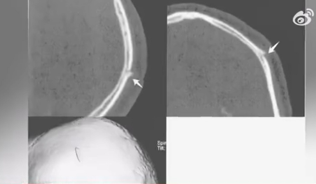 冲上热搜！遭男子踹门殴打，女子挥刀砍伤对方头部...上海检方做出这样的决定