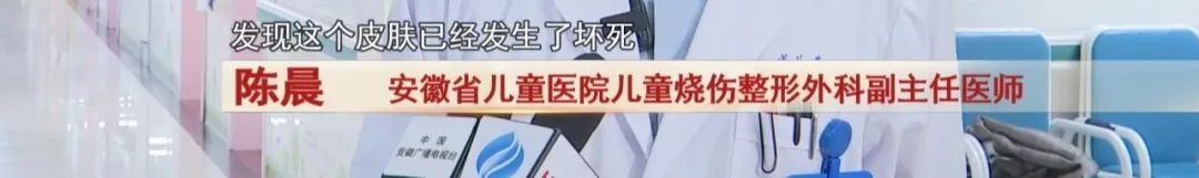 警惕！2岁幼童被502胶水“烧伤”