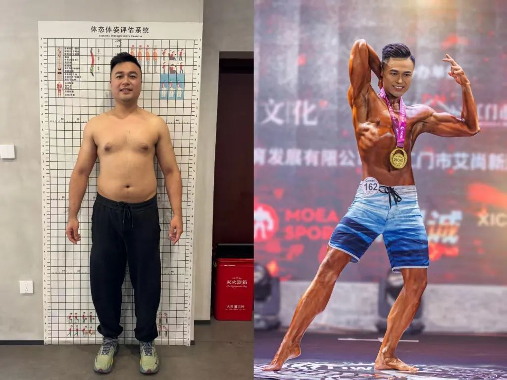 一个减重医生，减重后拿了健美冠军