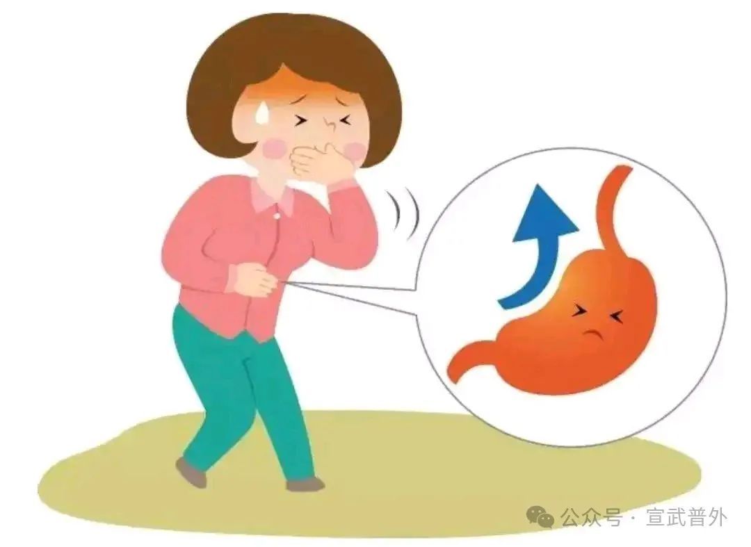 经常反酸、烧心，是怎么了？