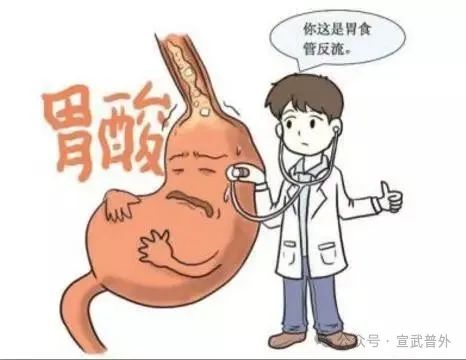 经常反酸、烧心，是怎么了？