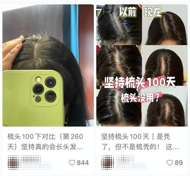 经常梳头 vs 不怎么梳头,到底哪种更健康? 经常梳头 vs 不怎么梳头,到底哪种更健康?
