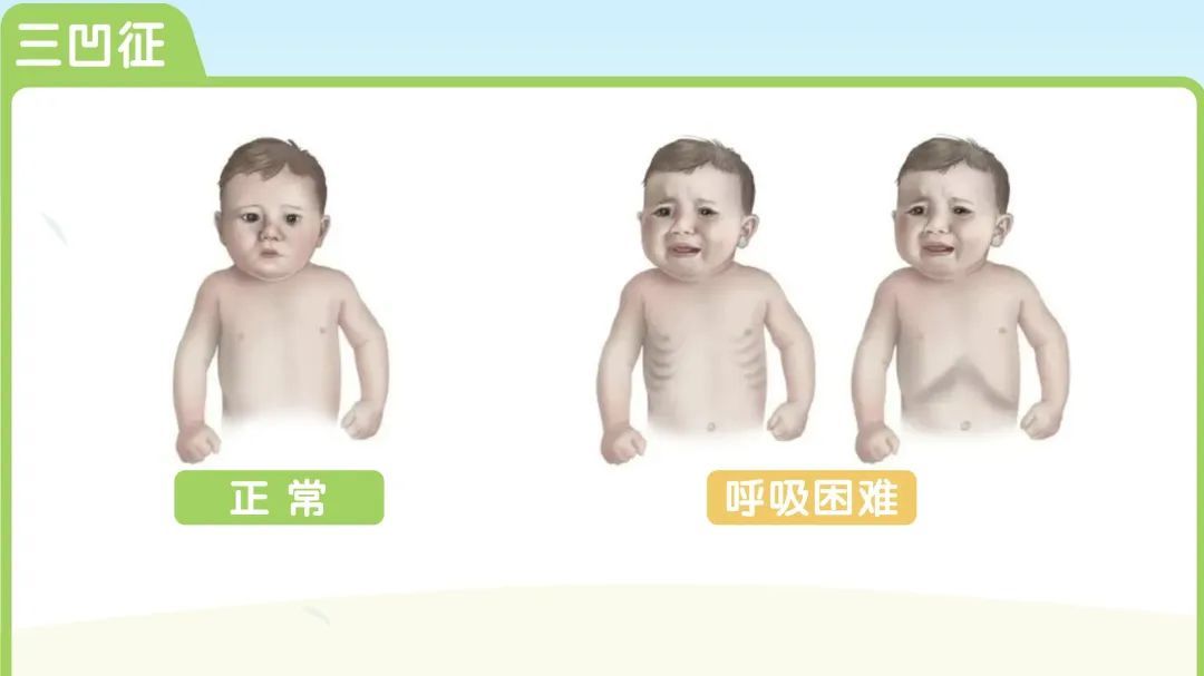 这种病毒春季高发，易“盯上”婴幼儿，尚无特效药！