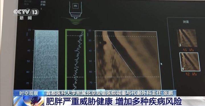 管住嘴、迈开腿、睡好觉！国家喊你减肥了→