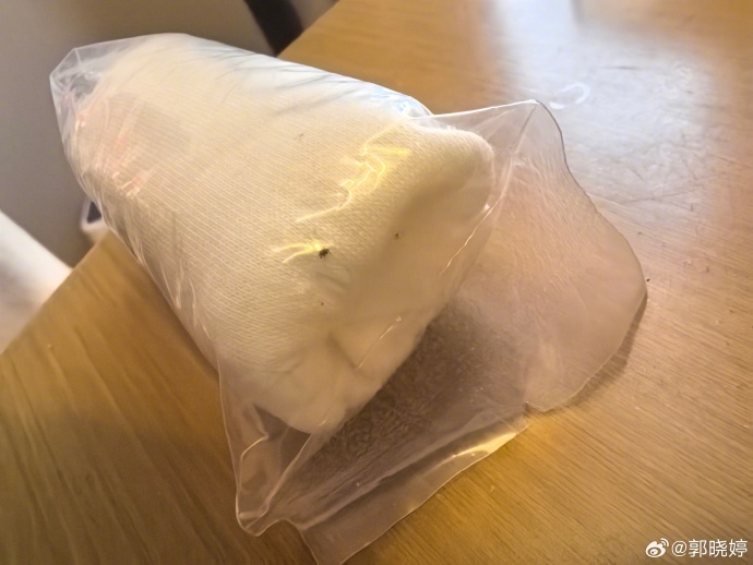 知名女星郭晓婷发声:购买的贴身衣物有霉斑! 知名女星郭晓婷发声:购买的贴身衣物有霉斑!