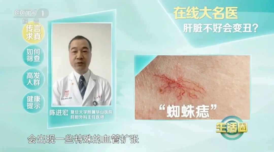 肝好不好,看脸就知道?这5个坏习惯快改 肝好不好,看脸就知道?这5个坏习惯快改