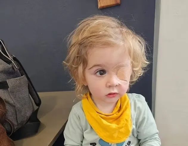 两岁宝宝因大人一个吻失明！眼角膜出现4毫米的穿孔，这种病毒屡见不鲜……