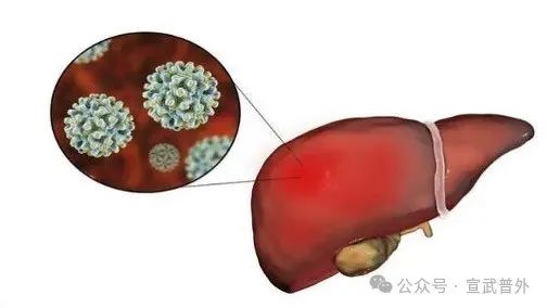 当冰箱变身生化武器库：一勺霉酱=20口砒霜？