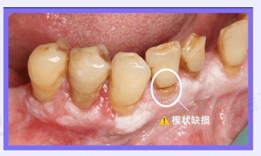 今天起，刷牙请调整一下！