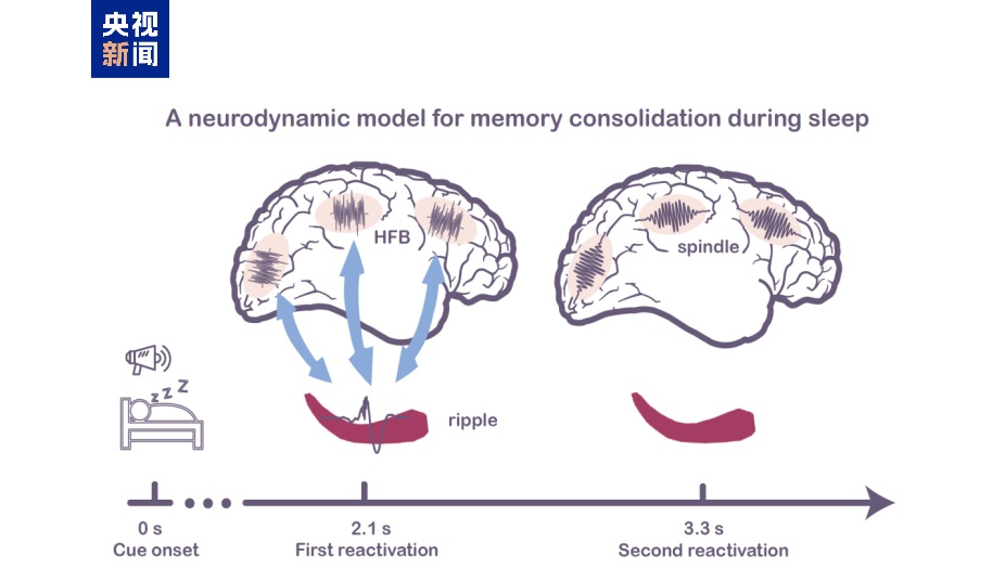 睡着时记忆如何巩固？我国科学家发现“回声”效应