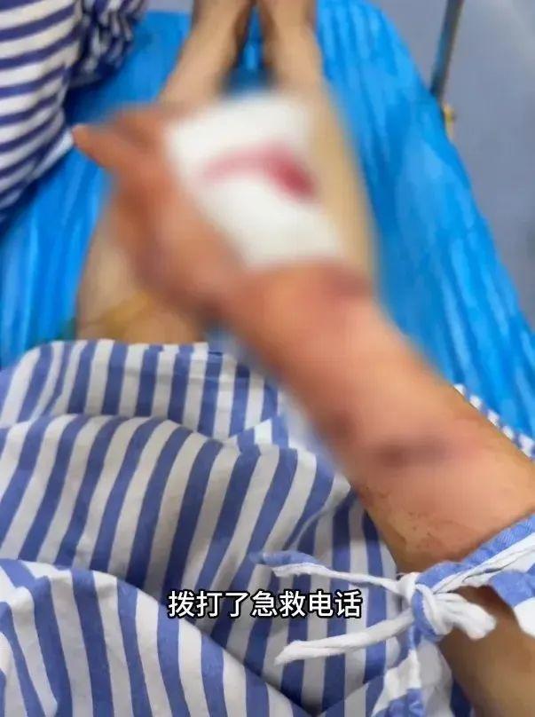 洗澡时它突然“自爆”，女子手筋断裂多处割伤！注意家里这个“隐形炸弹”→