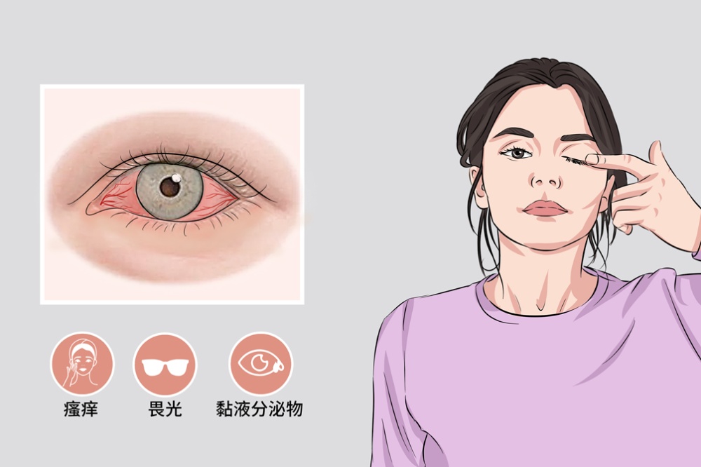 花粉似扬沙？“隔着屏幕都想打喷嚏！”一夜几百人进急诊，医生紧急提醒→