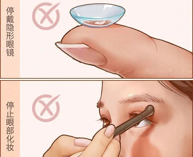 奇痒无比！一夜几百人进急诊，医生提醒：千万不要这么做