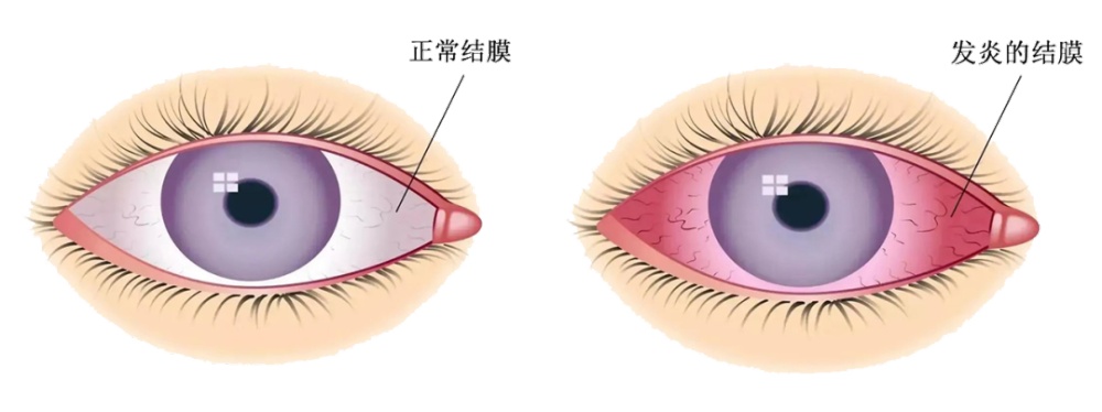 一夜接诊几百例，这种病到了高发期，最新提醒→