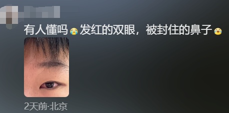 奇痒无比！一夜几百人进急诊，医生提醒：千万不要这么做