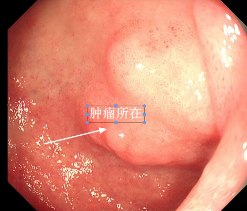 男子每天腹泻20多次！一查原因竟是… 注意！这些症状可能是“求救信号”