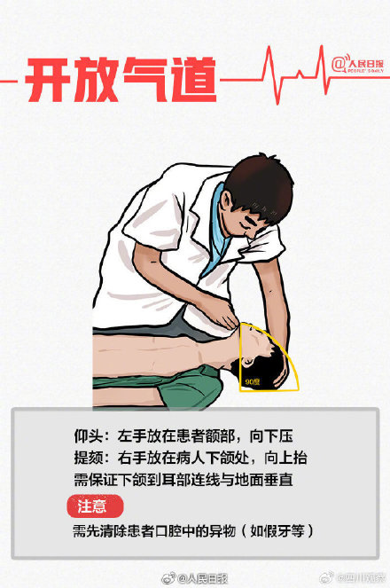 转扩！9图掌握心肺复苏法
