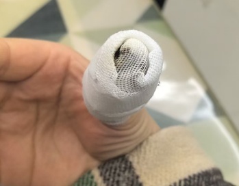 季节常见!不要拔!不要拔!不要拔! 季节常见!不要拔!不要拔!不要拔!