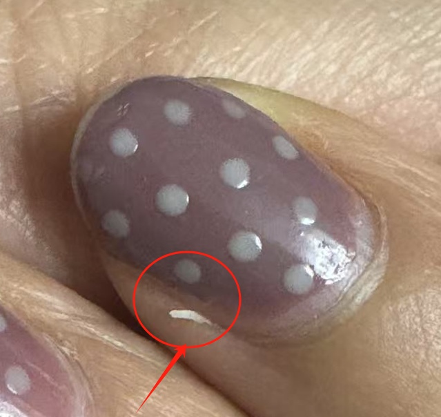 季节常见!不要拔!不要拔!不要拔! 季节常见!不要拔!不要拔!不要拔!