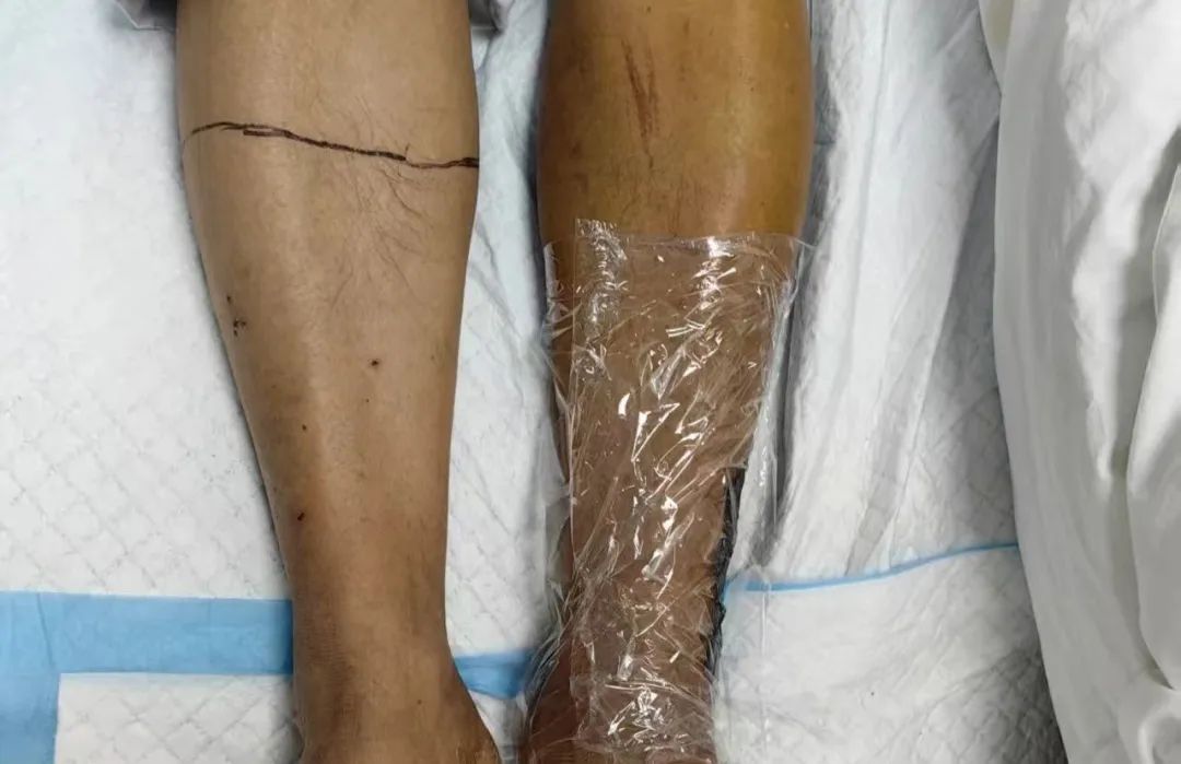 武汉这间24小时门诊,不到3天一台手术!医生提醒→ 武汉这间24小时门诊,不到3天一台手术!医生提醒→