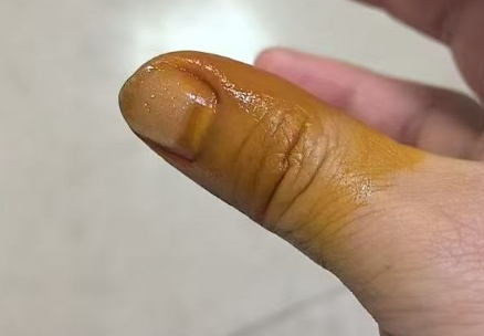 季节常见!不要拔!不要拔!不要拔! 季节常见!不要拔!不要拔!不要拔!