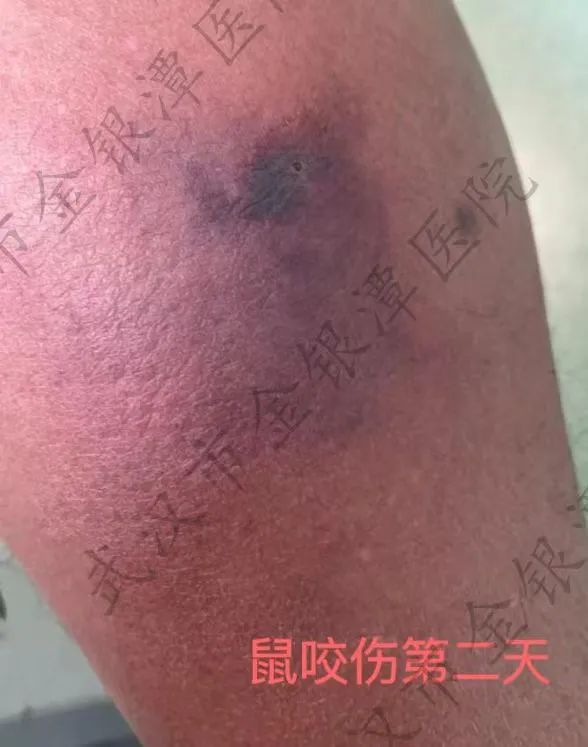 武汉这间24小时门诊,不到3天一台手术!医生提醒→ 武汉这间24小时门诊,不到3天一台手术!医生提醒→