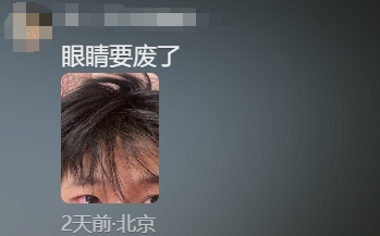 “眼睛快要被揉爆了!”近期高发,紧急提醒 “眼睛快要被揉爆了!”近期高发,紧急提醒